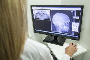 Gnatologia Boccea